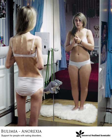 causas de la bulimia. la Anorexia , es un trastorno